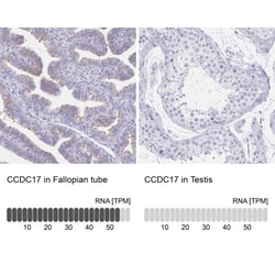 CCDC17 Antibody, Novus Biologicals 0.1mL; Unlabeled:Antibodies, Polyclonal